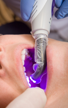 Does Different Types of Dental Fillings Exists?