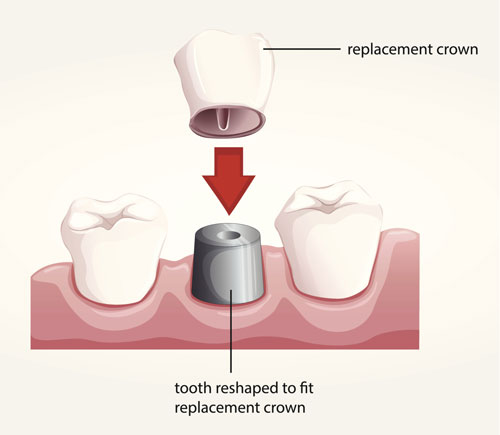  Cavity Nancy Shiba, DDS CA 95116-1903