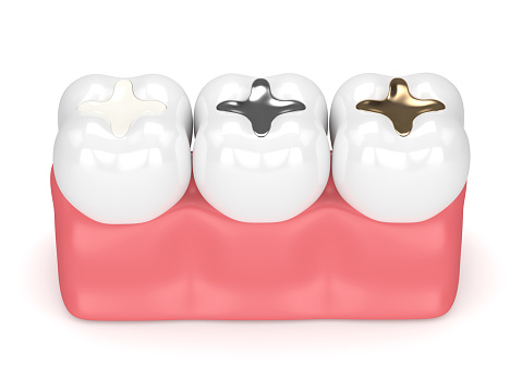 types of fillings