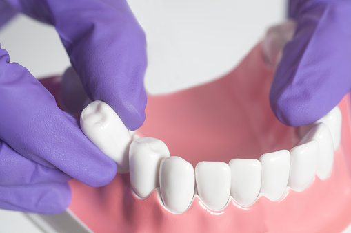 Reasons We Avoid an Extraction Whenever Possible
