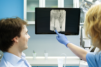 3-D CBCT Scans: How Do They Work? Are They Safe? Find Out!
